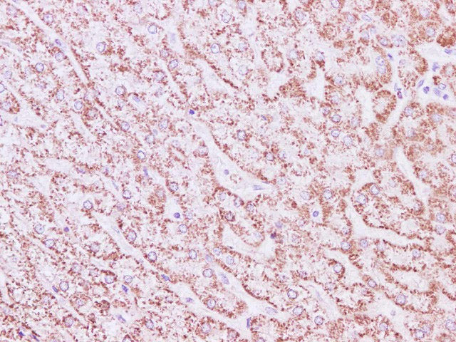 SDHA Polyclonal Antibody