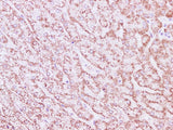 SDHA Polyclonal Antibody