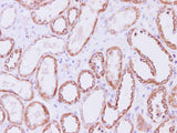 SDHA Polyclonal Antibody