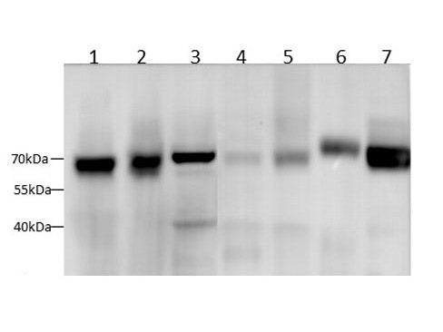 SDHA Polyclonal Antibody