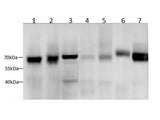 SDHA Polyclonal Antibody
