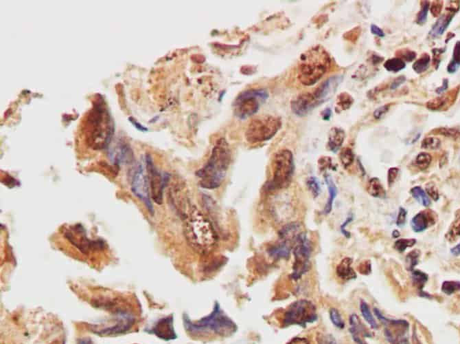 STOML2 Polyclonal Antibody Host Rabbit
