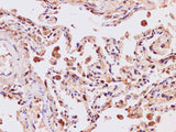 IP3KB Polyclonal Antibody