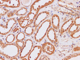 IP3KB Polyclonal Antibody