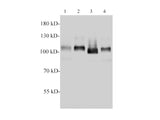 MCM3 Polyclonal Antibody Reactivity Human