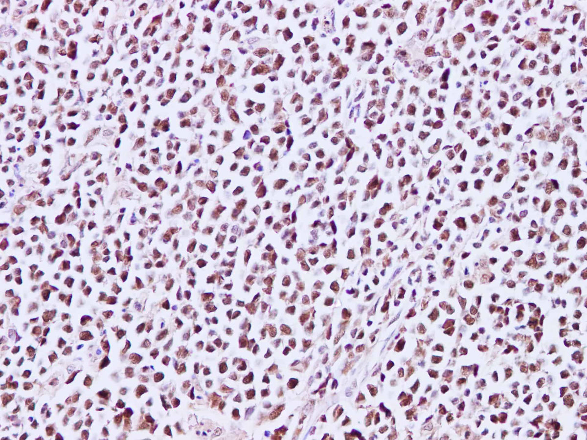 MCM3 Polyclonal Antibody Reactivity Human - Biomarkers - Elabscience Biotechnology - MSE Supplies