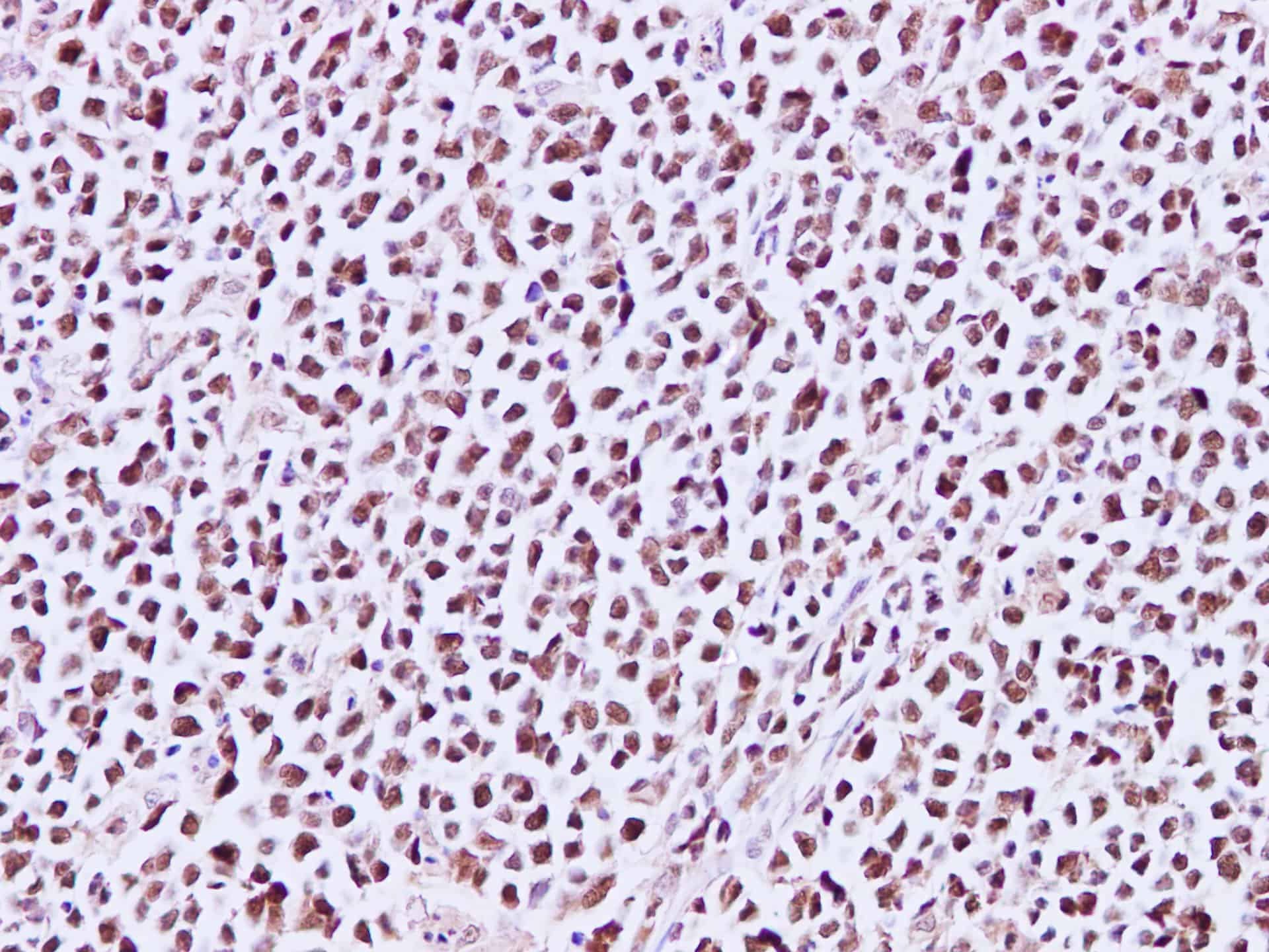 MCM3 Polyclonal Antibody Reactivity Human - Biomarkers - Elabscience Biotechnology - MSE Supplies