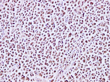 MCM3 Polyclonal Antibody Reactivity Human - Biomarkers - Elabscience Biotechnology - MSE Supplies