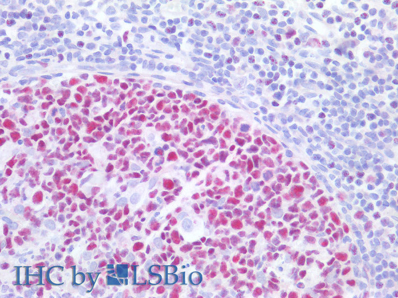 MCM3 Polyclonal Antibody Reactivity Human - Biomarkers - Elabscience Biotechnology - MSE Supplies