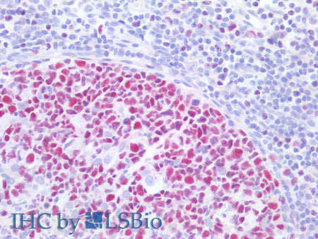 MCM3 Polyclonal Antibody Reactivity Human - Biomarkers - Elabscience Biotechnology - MSE Supplies