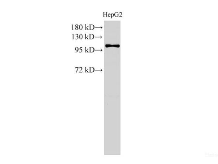 MCM3 Polyclonal Antibody Reactivity Human - Biomarkers - Elabscience Biotechnology - MSE Supplies