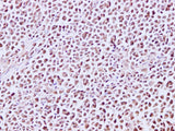 MCM7 Polyclonal Antibody Host Rabbit