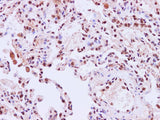 STIL Polyclonal Antibody Host Rabbit