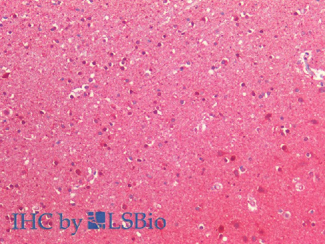 NEDD8 Polyclonal Antibody Host Rabbit