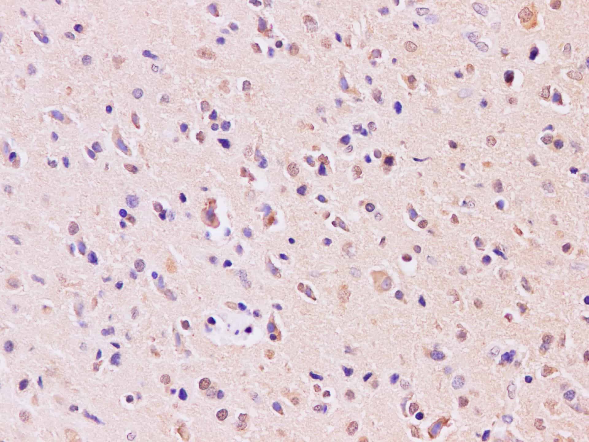 RAB5A Polyclonal Antibody Host Rabbit