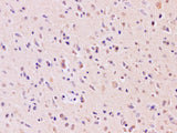 RAB5A Polyclonal Antibody Host Rabbit