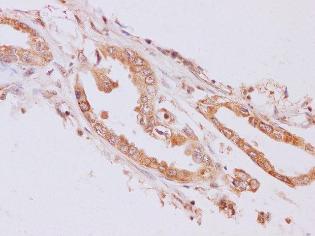 RAB5A Polyclonal Antibody Host Rabbit