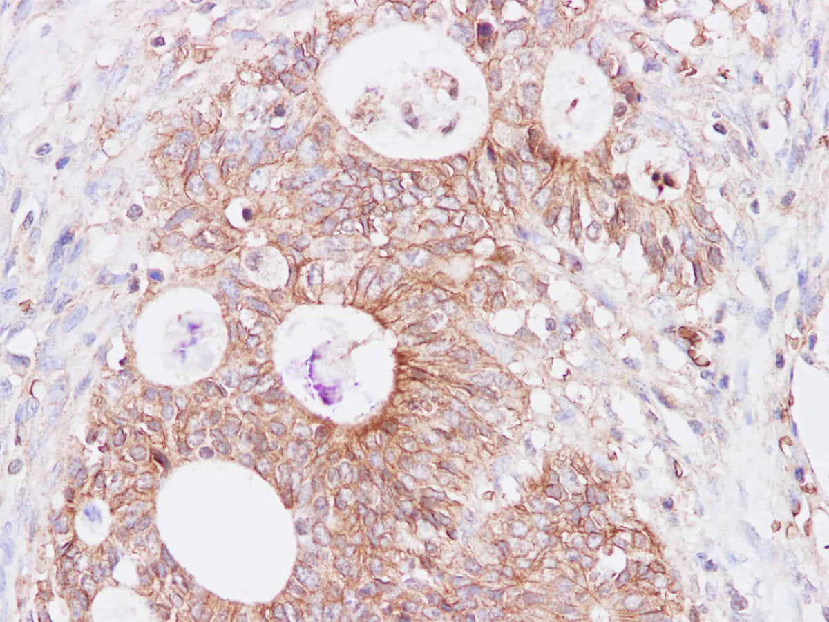 SNP23 Polyclonal Antibody
