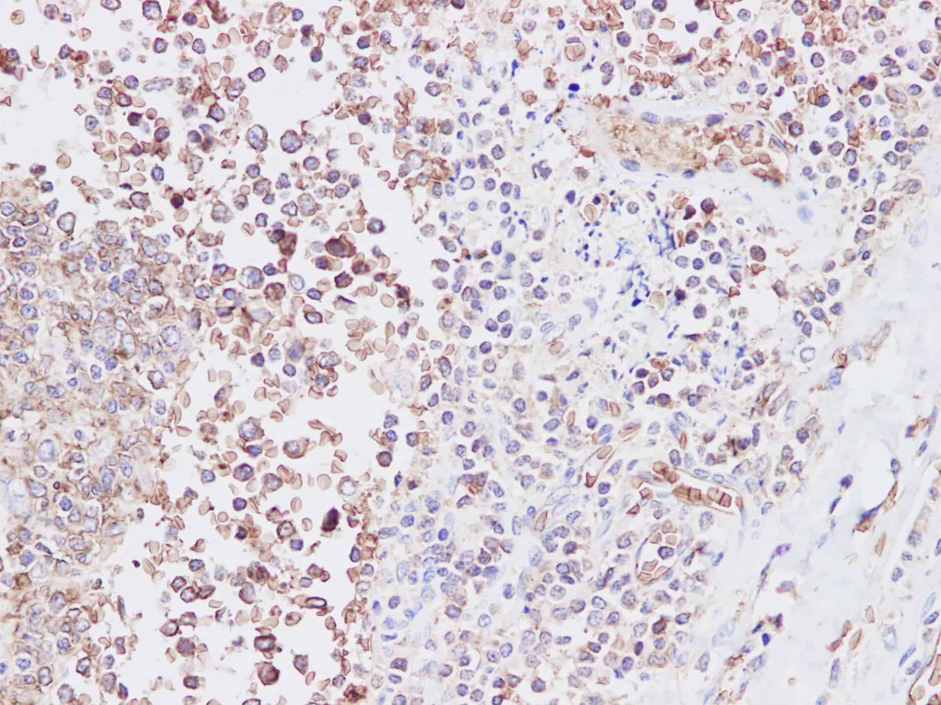 SNP23 Polyclonal Antibody
