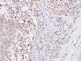 SNP23 Polyclonal Antibody