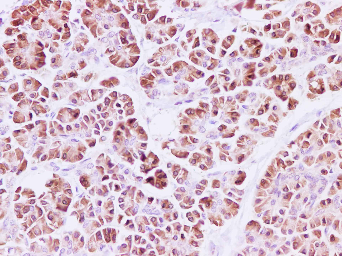 RPLP1 Polyclonal Antibody Reactivity Human