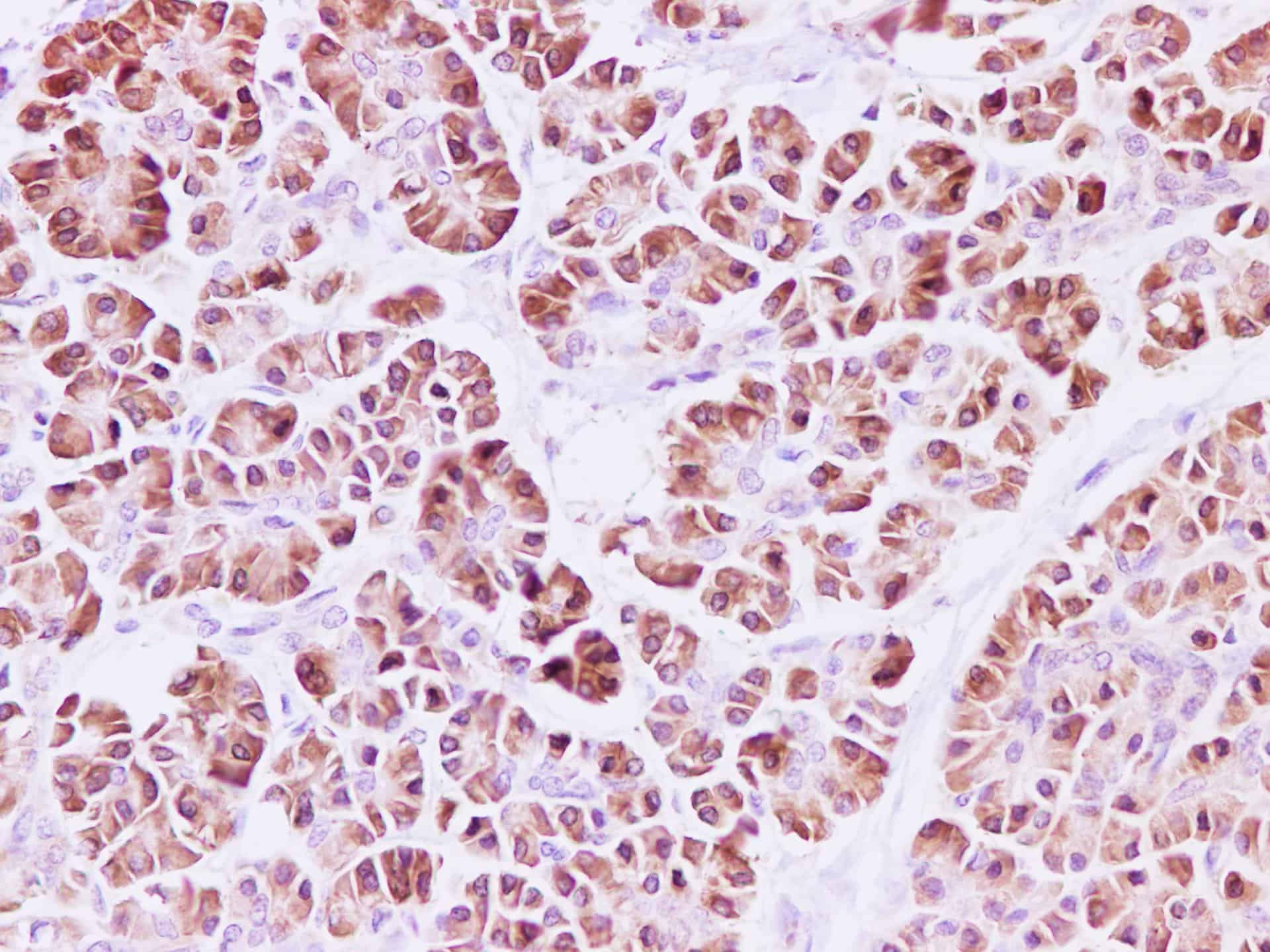 RPLP1 Polyclonal Antibody Reactivity Human