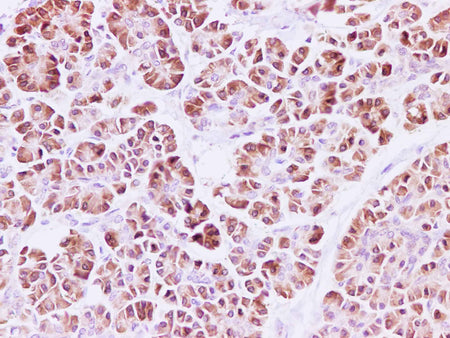 RPLP1 Polyclonal Antibody Reactivity Human