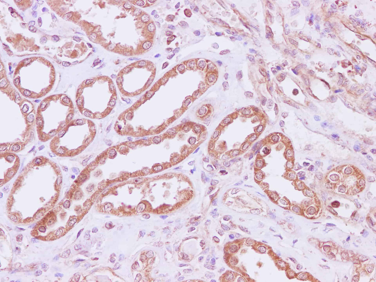 RPLP1 Polyclonal Antibody Reactivity Human