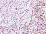 RAC2 Polyclonal Antibody Host Rabbit