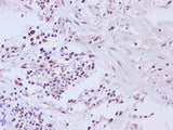 CCNL2 Polyclonal Antibody