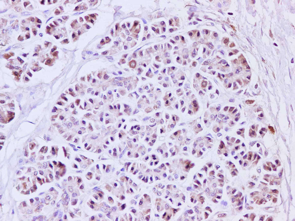 IL1A Polyclonal Antibody Host Rabbit