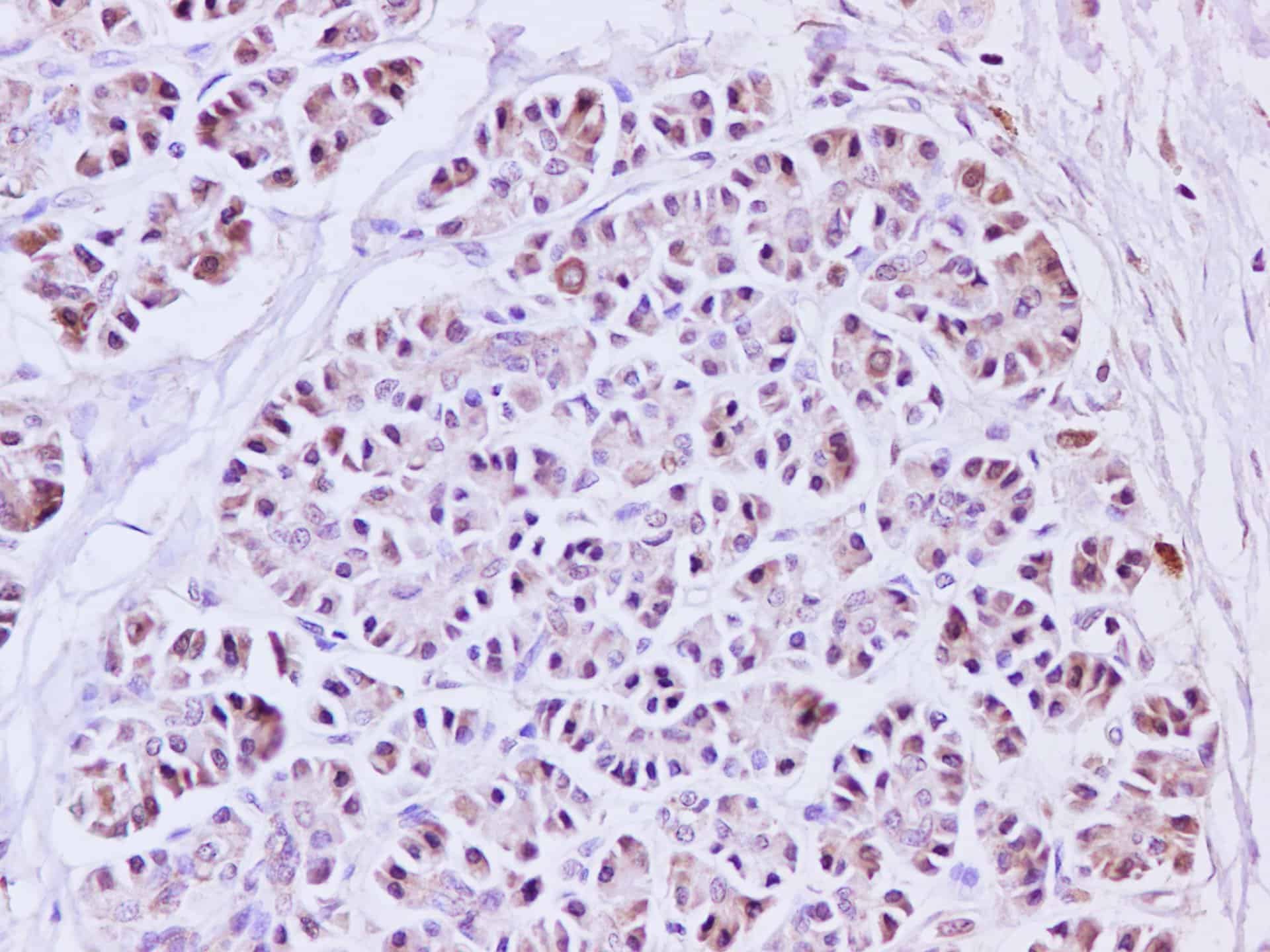IL1A Polyclonal Antibody Host Rabbit