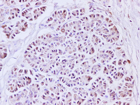 IL1A Polyclonal Antibody Host Rabbit