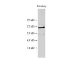 AIFM1 Polyclonal Antibody Host Rabbit