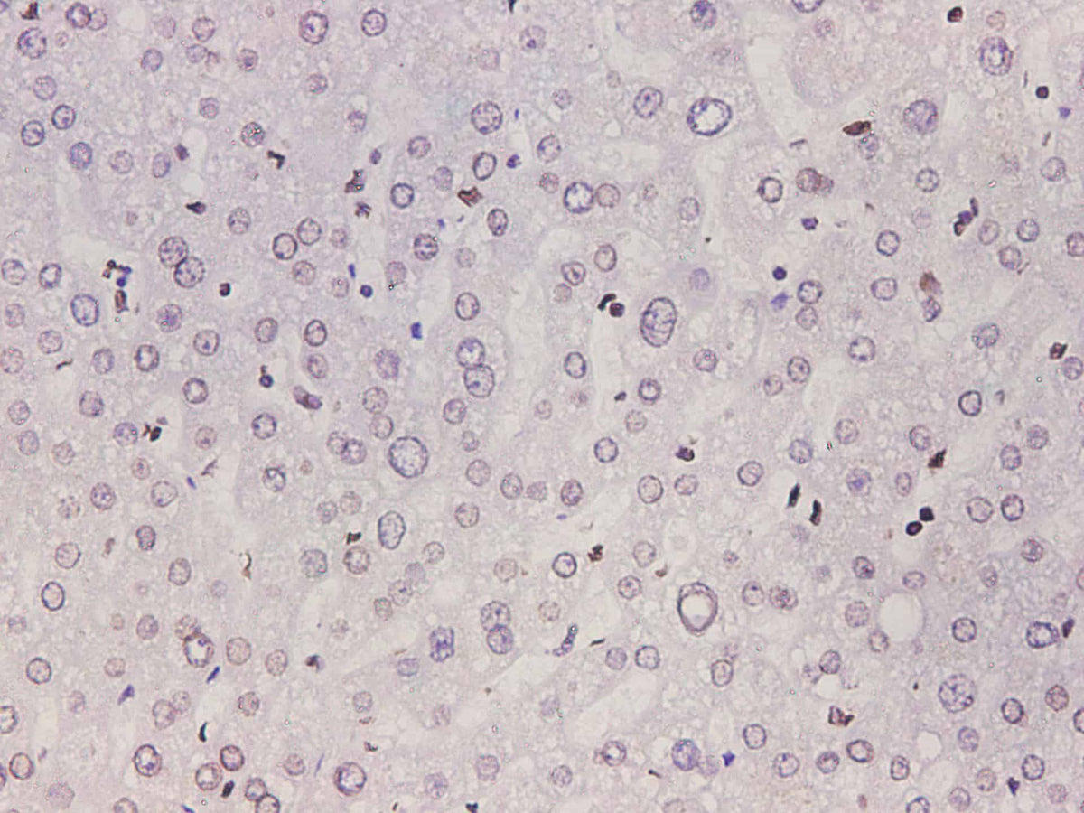 Lamin B1 Polyclonal Antibody Host Rabbit