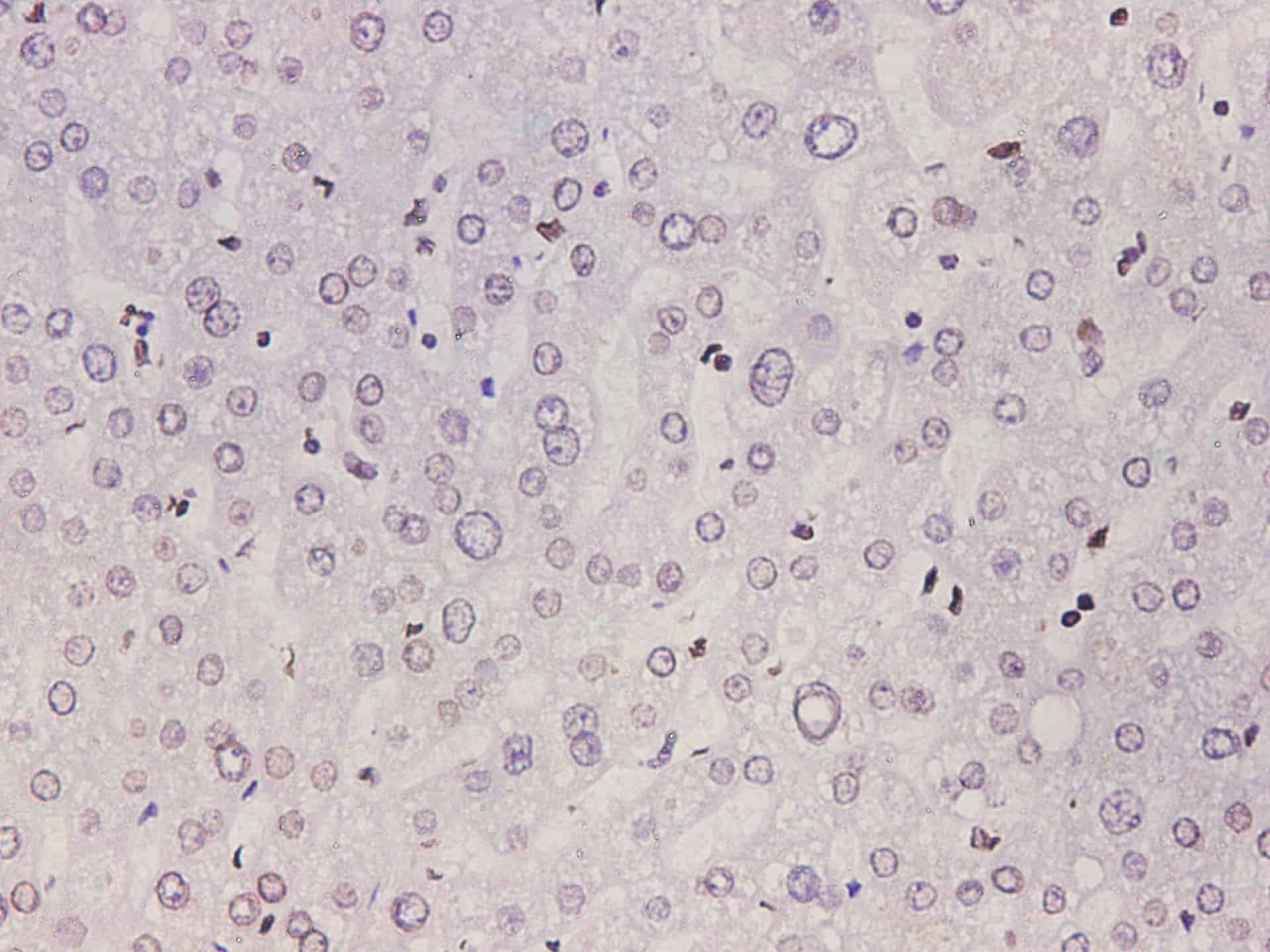 Lamin B1 Polyclonal Antibody Host Rabbit