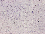 Lamin B1 Polyclonal Antibody Host Rabbit