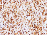 Lamin B1 Polyclonal Antibody Host Rabbit