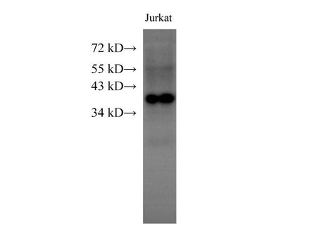HMG20B Polyclonal Antibody Host Rabbit