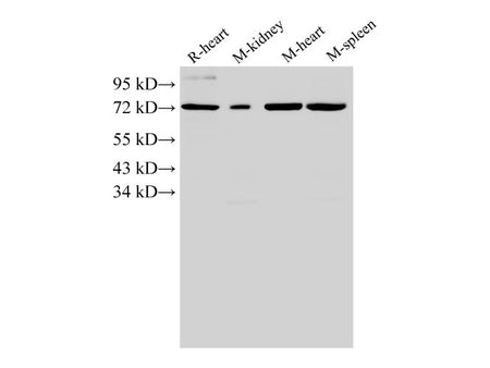 ANXA6 Polyclonal Antibody