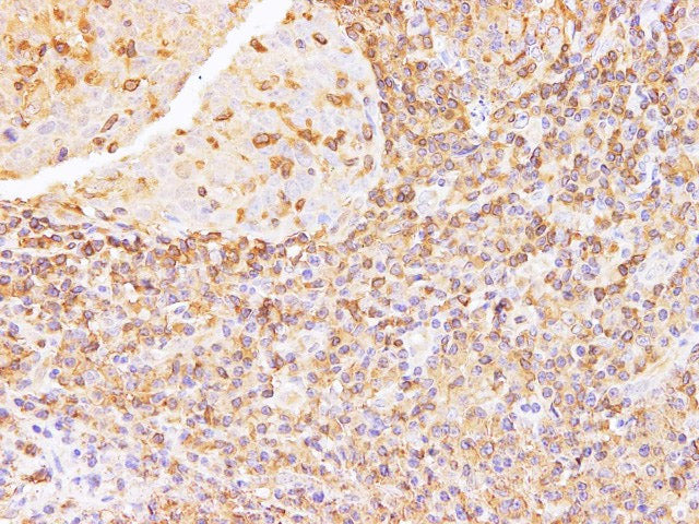 ANXA6 Polyclonal Antibody