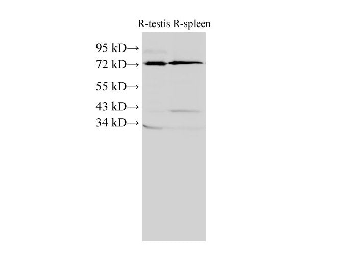 ANXA6 Polyclonal Antibody