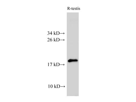 AK6 Polyclonal Antibody Host Rabbit