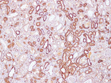 SPTAN1 Polyclonal Antibody Host Rabbit