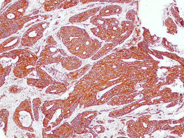 SPTAN1 Polyclonal Antibody Host Rabbit