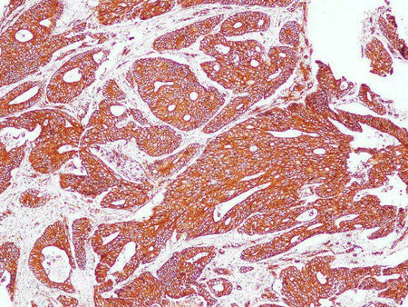SPTAN1 Polyclonal Antibody Host Rabbit