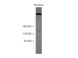 SPTAN1 Polyclonal Antibody Host Rabbit