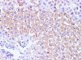 GCK Polyclonal Antibody Host Rabbit