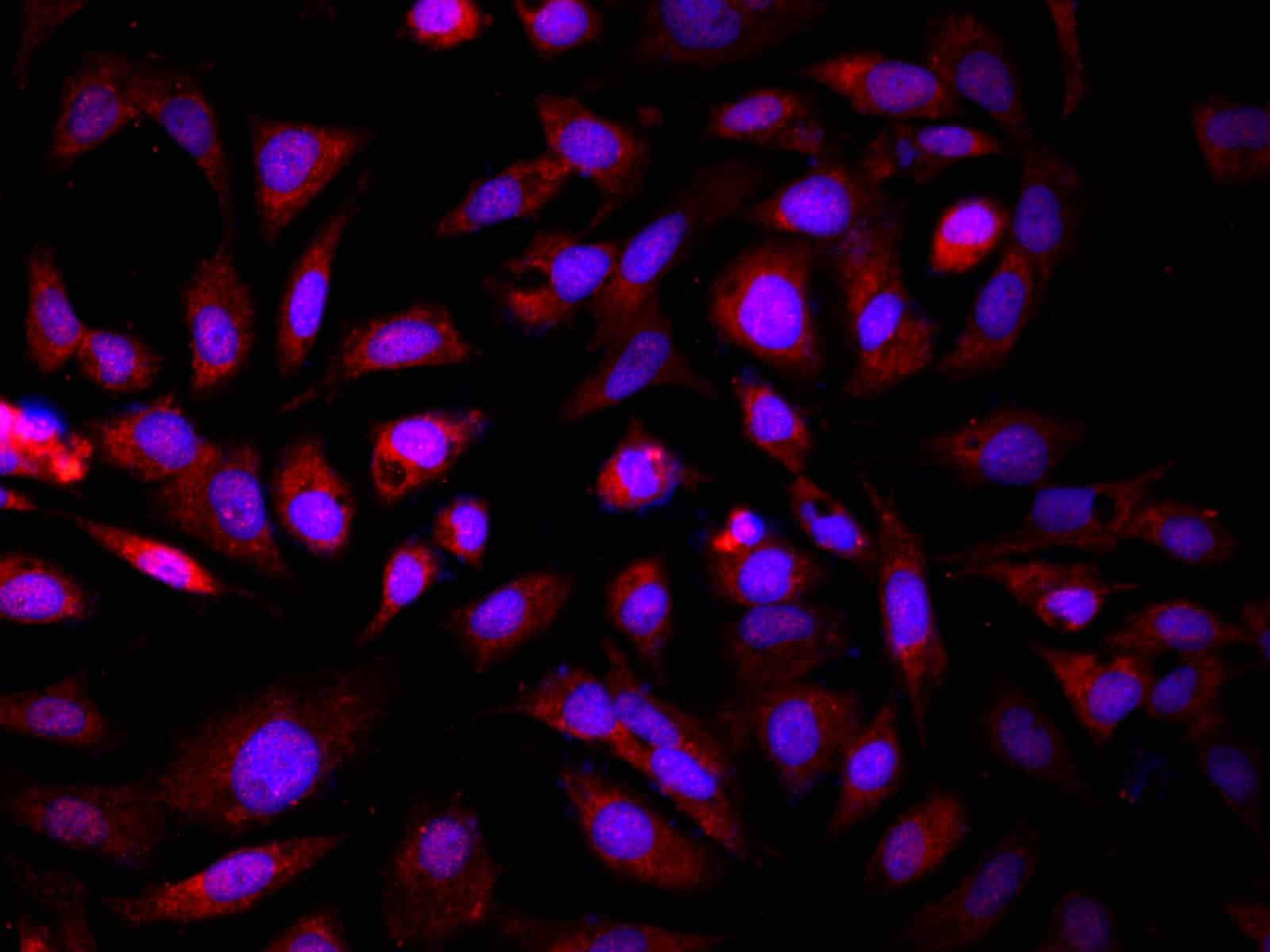 GCK Polyclonal Antibody Host Rabbit