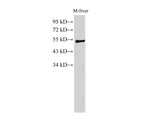 GCK Polyclonal Antibody Host Rabbit